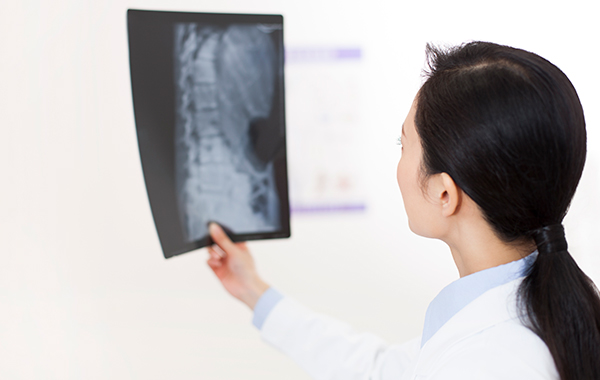 White-Coat-Female-Doctor-holding-onto-Xray-Film-NoFrills-Chiropractic-Singapore