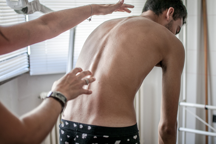 Chiropractor checking spine for scoliosis