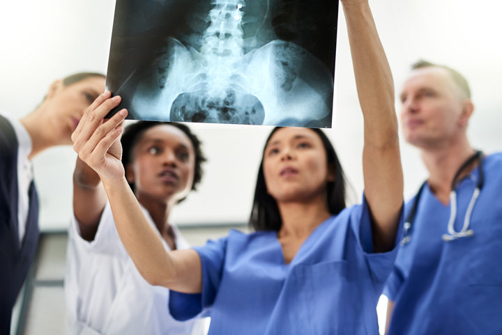 Assessing Scoliosis Xray